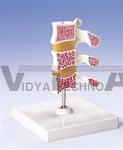 Deluxe Osteoporosis Model (3 Vertebrae)